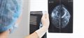 Drugs for invasive breast cancer 'could treat earliest stages of the disease'