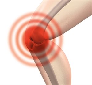 Artist's impression of pain at the knee