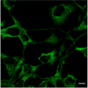 Microscopic Image of RNA demethylation