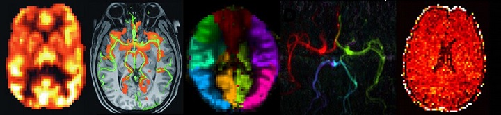mri-brain scans-720