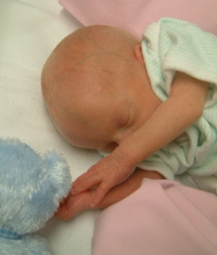 Premature baby lying on side