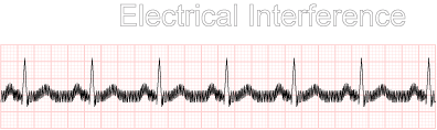 Electrical interference