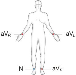 Diagram showing heart position in relation to the rib cage