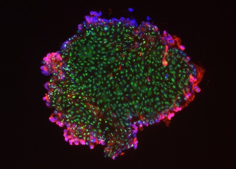 Neural progenitors (pink) in the periphery of a colony of  embryonic stem cells (green)