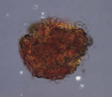 pancreatic islet cells in culture