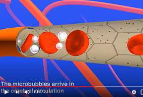 ultrasound 285 x 196 b