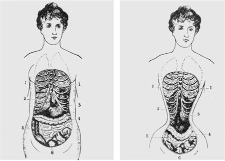 A (biologically inaccurate) image of a corset's impact on the body