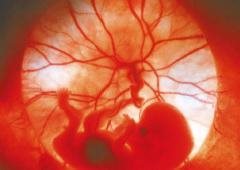 A developing foetus with the placenta visible behind