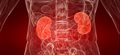 MRI to offer advances in treatment for chronic kidney disease