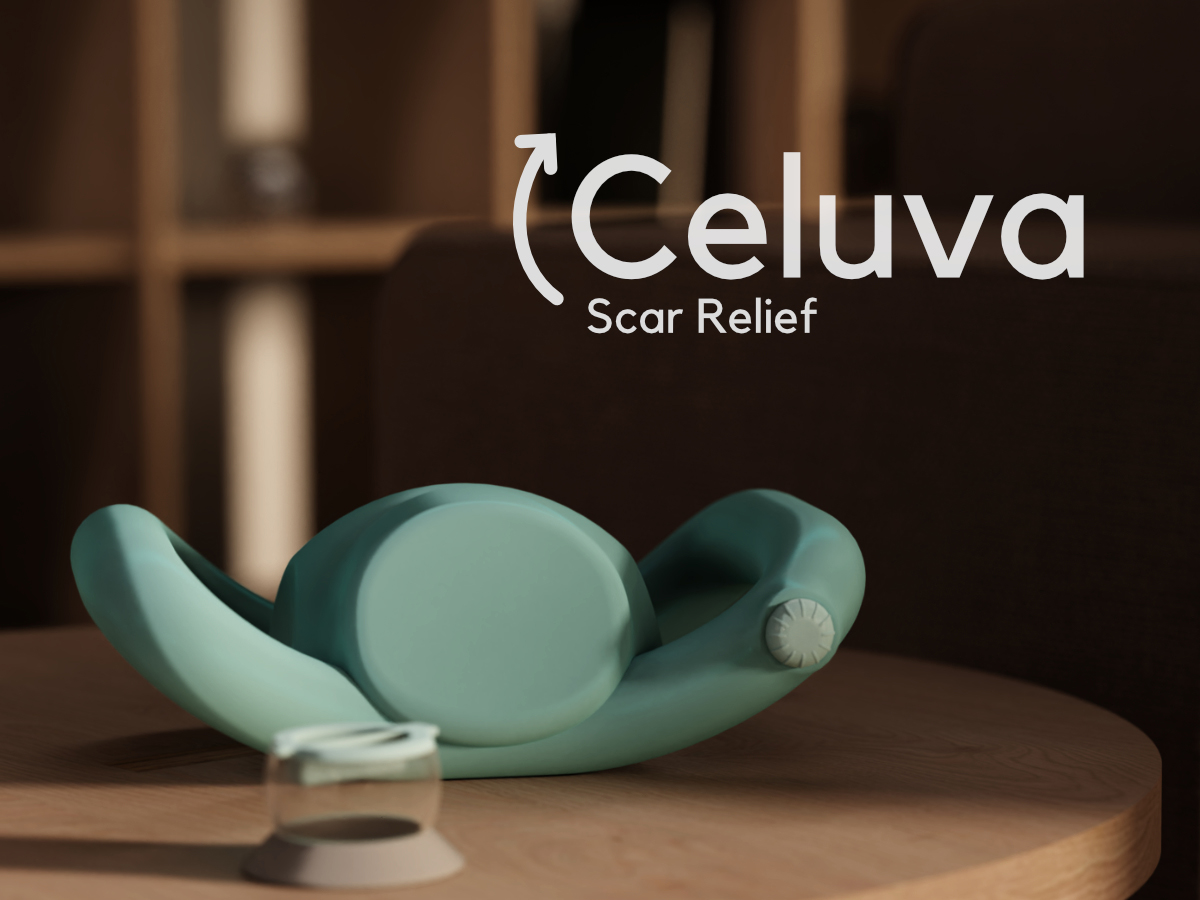 A personal negative pressure wound therapy device for aiding the recovery of C-section scars