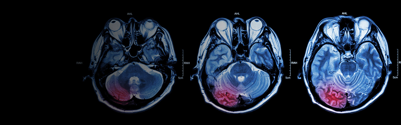 Brain scans from an MRI machine
