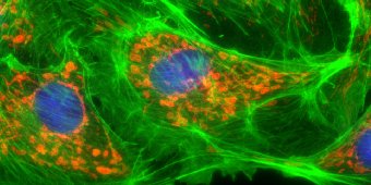 fluorescent fixed cells