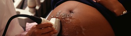 A pregnant woman undergoing an ultrasound scan