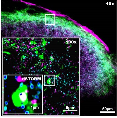 Example of an image from the STORM tool