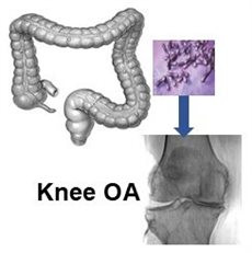 Microbiome - OA axis_final.