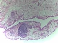 Wyatt et al_human image for lay summary dec 2017