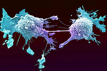 Cancer-cells-dividing-web Anne Weston, EM STP, the Francis Crick Institute/SCIENCE PHOTO LIBRARY