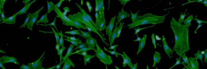 banner_fibroplastCells