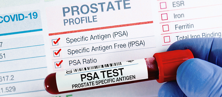 Image of prostate specific antigen test