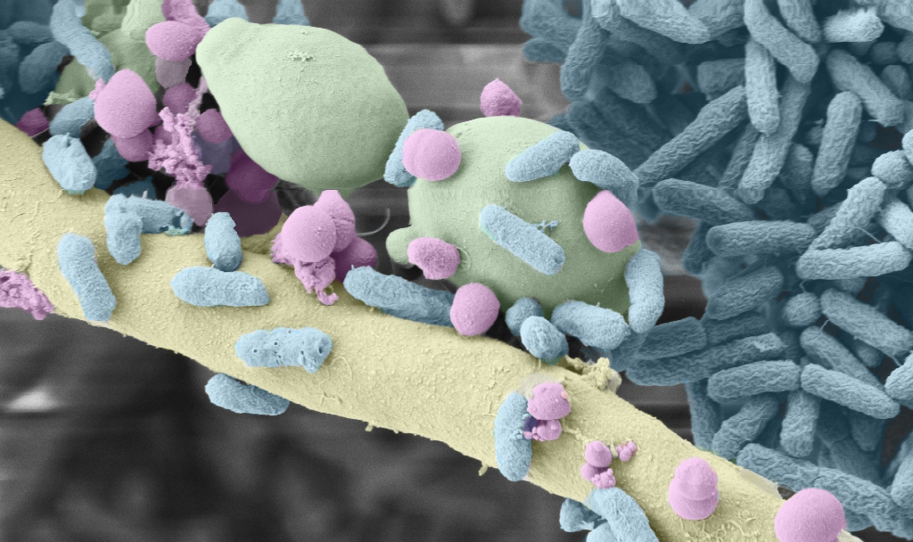 A false-coloured picture of a biofilm with Pseudomoans aeruginosa and Staphylococcus aureus bound to Candida albicans hyphae under anoxic conditi