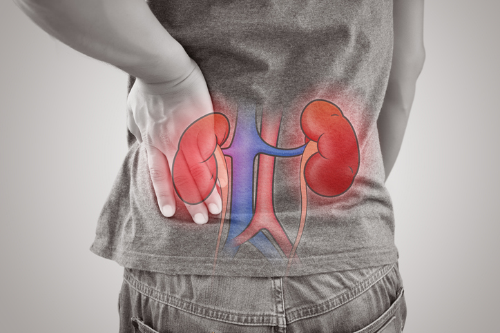 Kidney injury