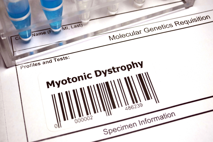 Myotnic Dystrophy