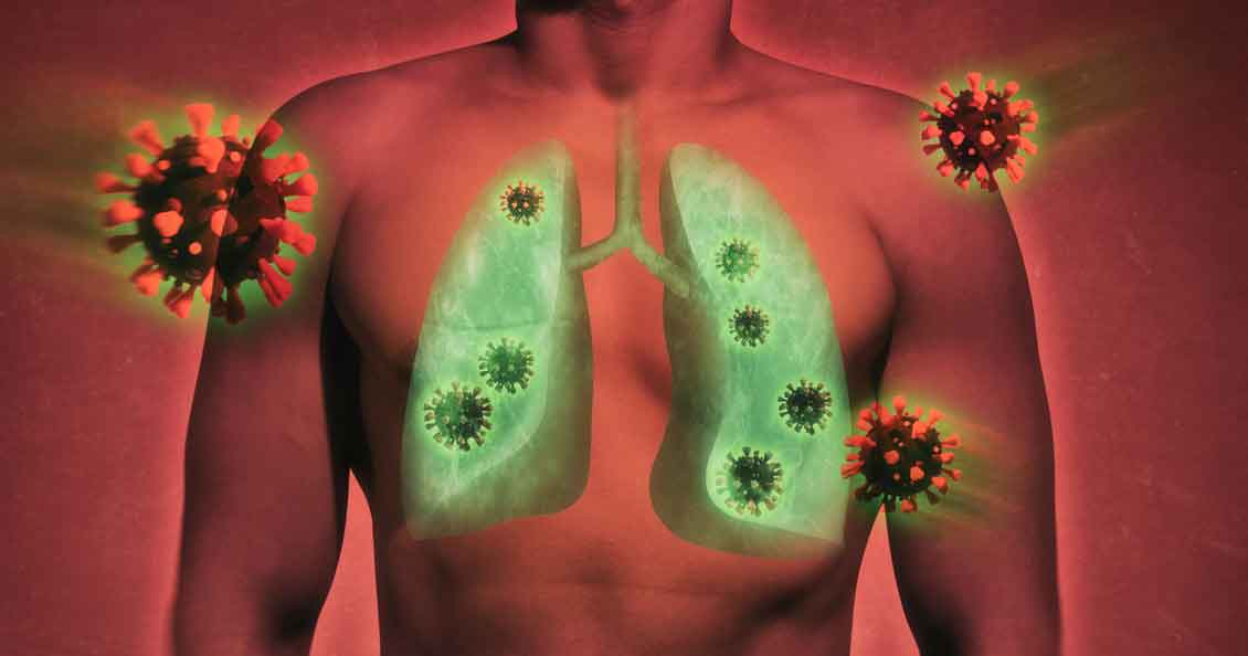 News New national study of longterm impacts of debilitating lung