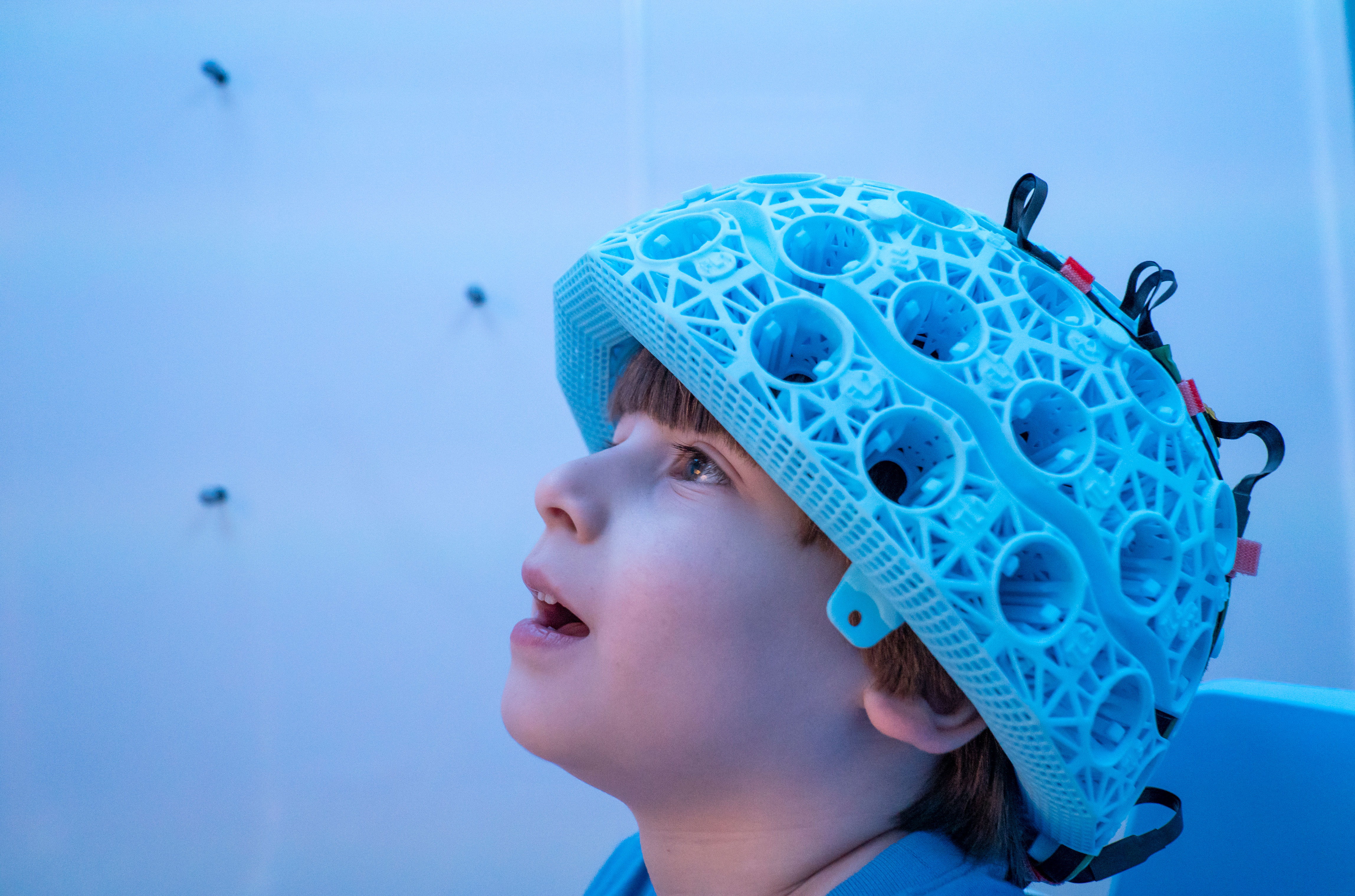 Brain Imaging Is on the Move with Wearable Scanning Development