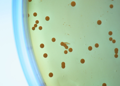 Bacteria on petri dish