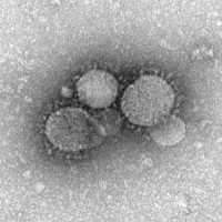 Coronavirus particles
