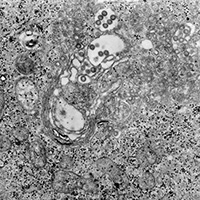 Transmission electron micrograph of Rift Valley fever virus in infected tissue