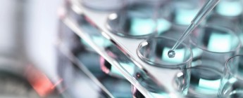 A pipette over a row of test tubes