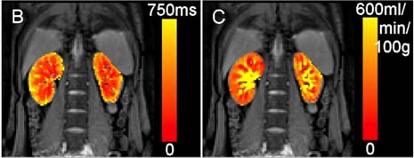 Kidney scans