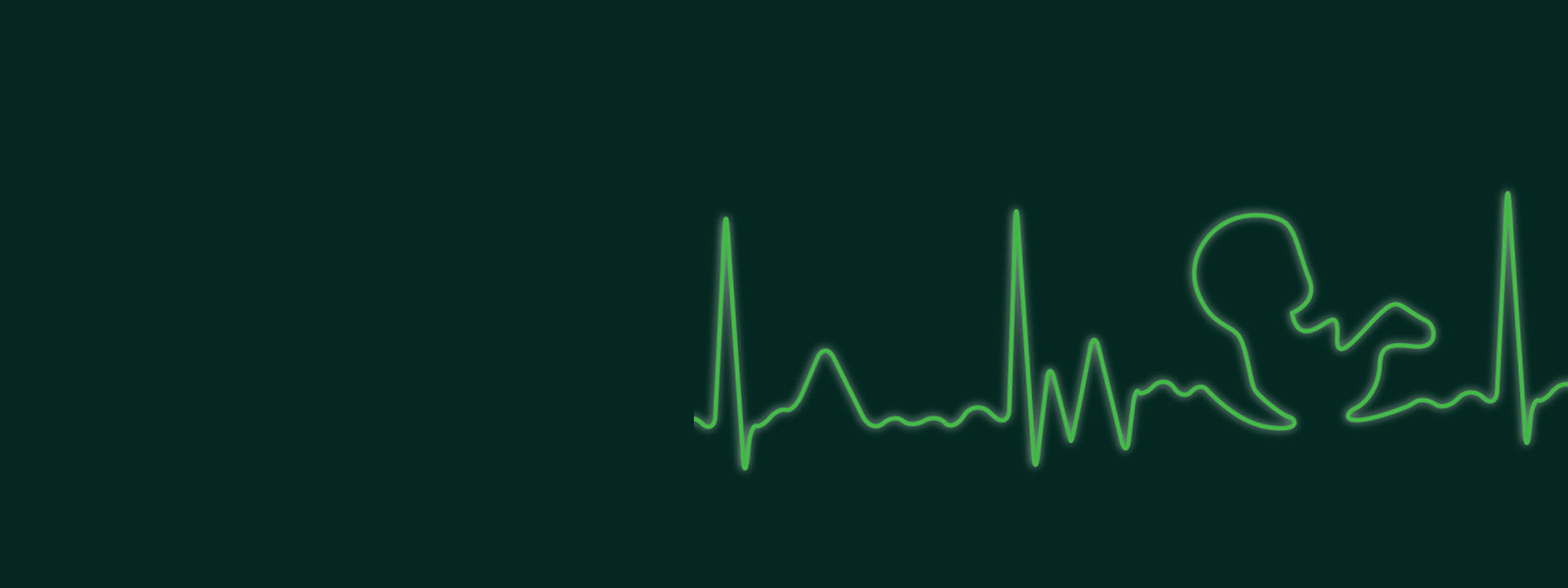 Illustration of a heart monitor graph