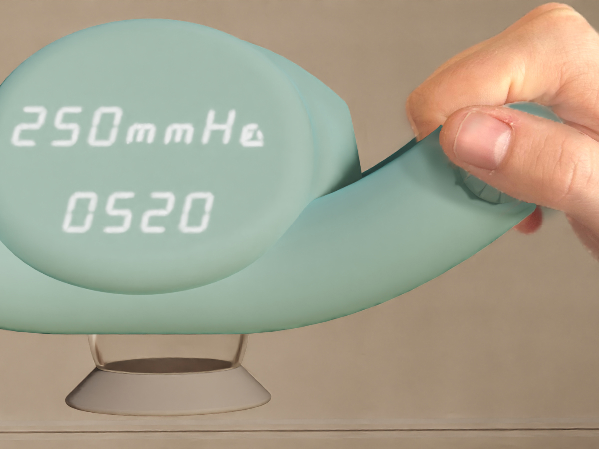 A personal negative pressure wound therapy device for aiding the recovery of C-section scars.