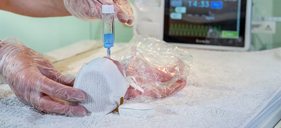 A new-born baby being monitored using the SurePulse technology