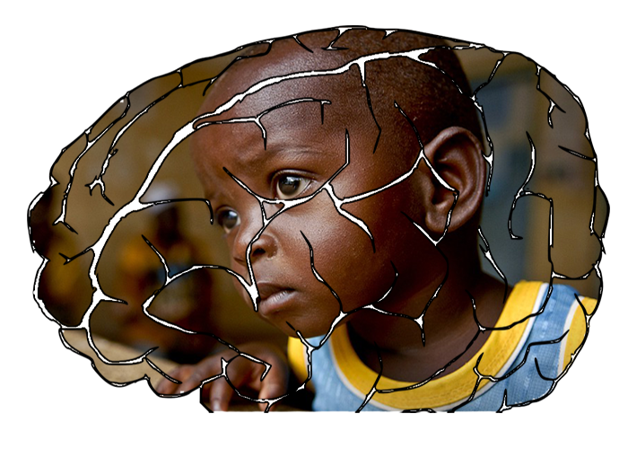 Placeholder image text