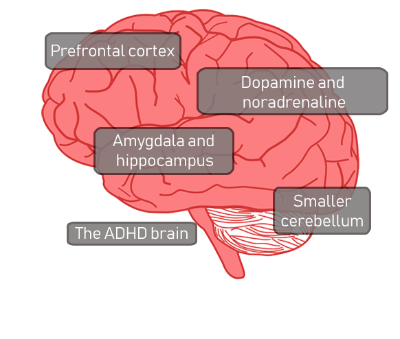 https://www.nottingham.ac.uk/helm/dev/adhd/understanding_adhd/images/brain.gif?utm_source=chatgpt.com
