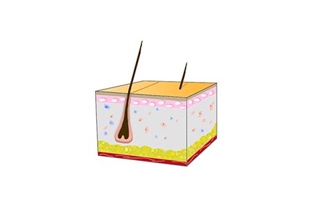 Illustration of skin