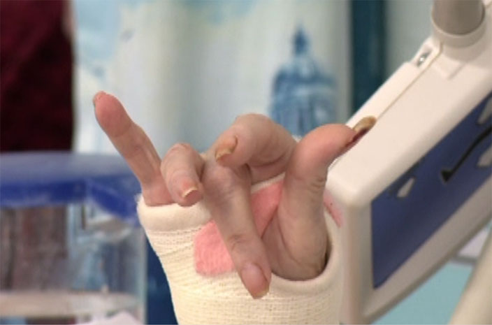Helpful communication strategies - bandaged hand