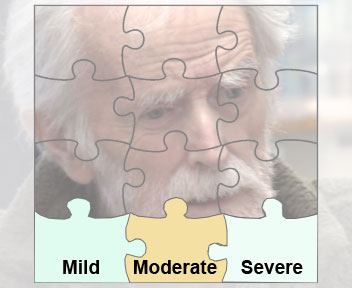 Dementia and cognitive loss
