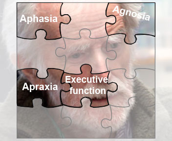 Dementia and cognitive loss