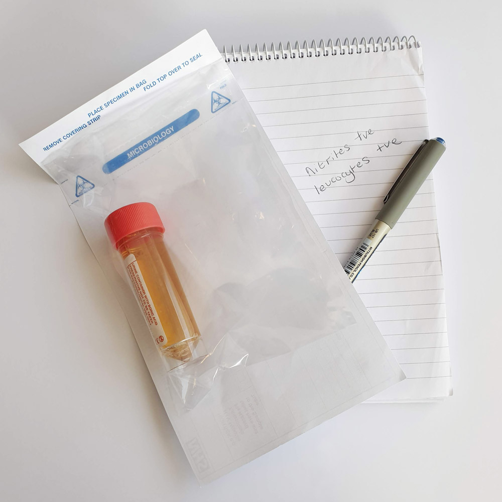 Florence's urine specimen with accoumpanying note indicating Leucocytes +ve and Nitrites +ve