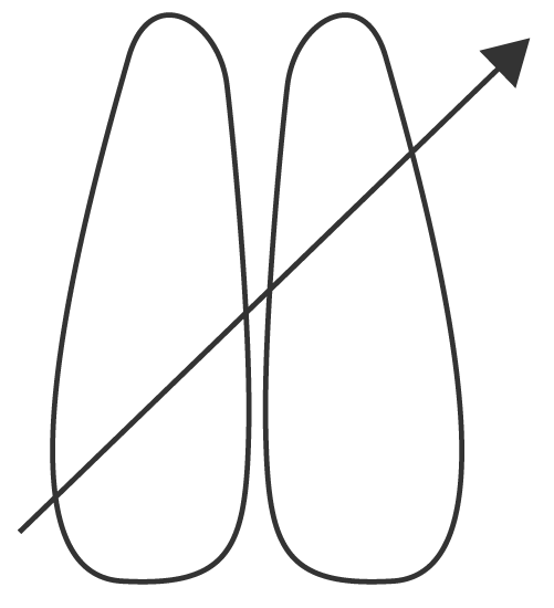 diagram of lungs with arrow passing from bottom left to top right