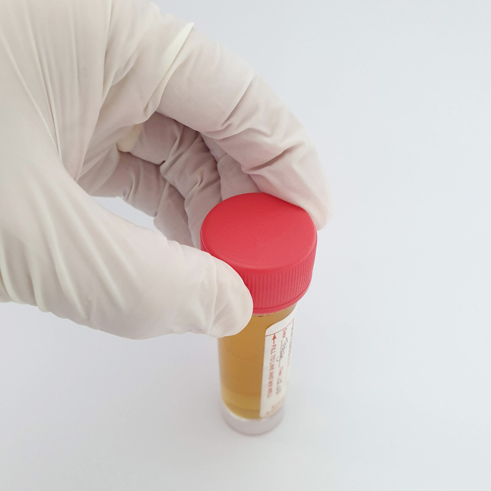 Secure specimen container lid