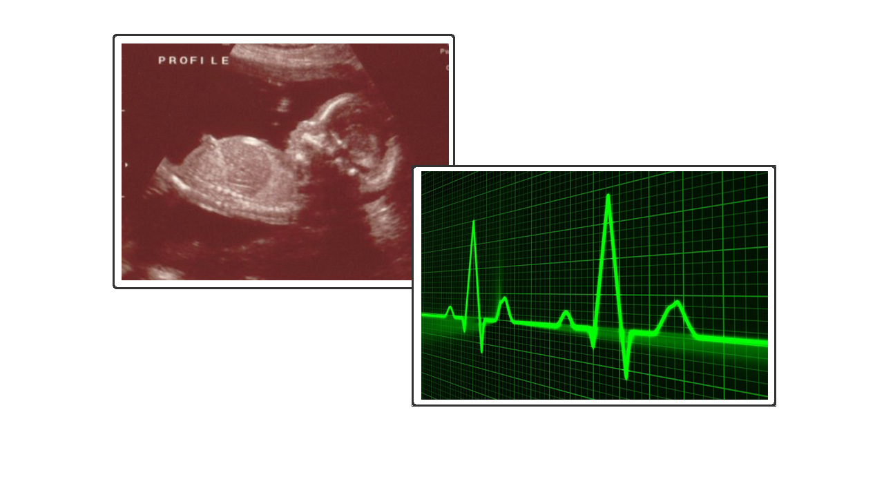a picture of a close up of a babies eyes and a heart monitor.