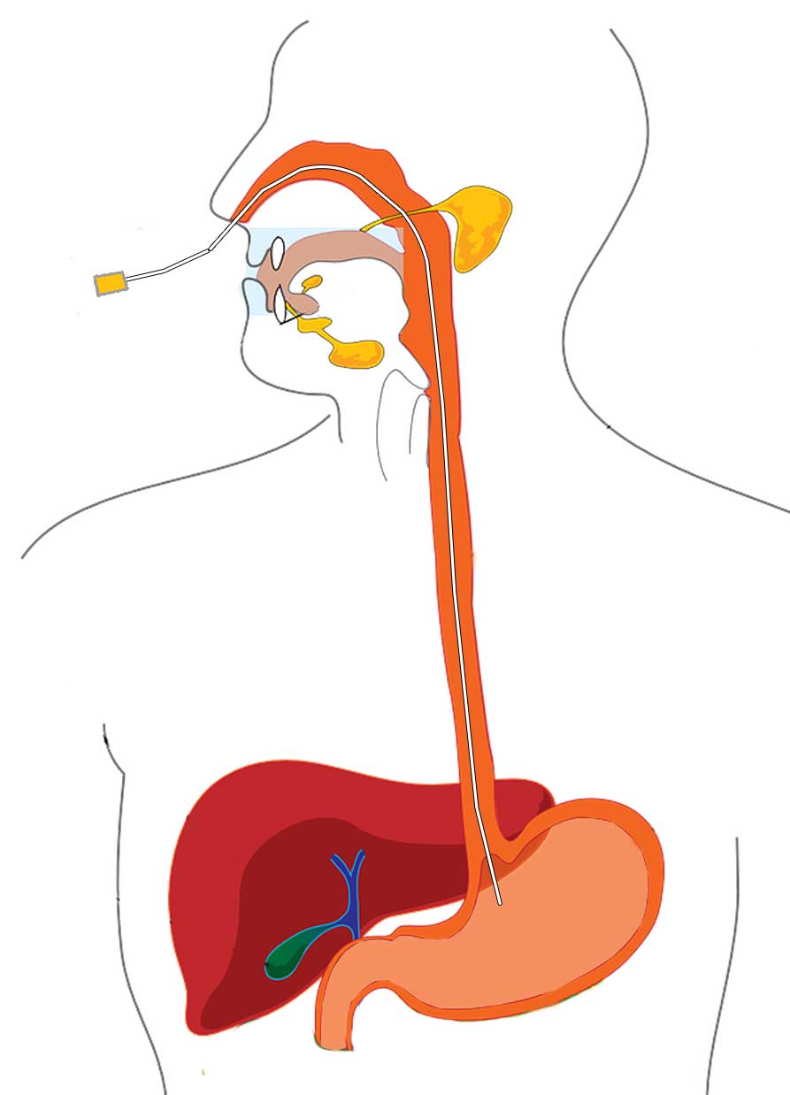 Diagram showing food pipe inside oesophagus leading directly into the stomach.