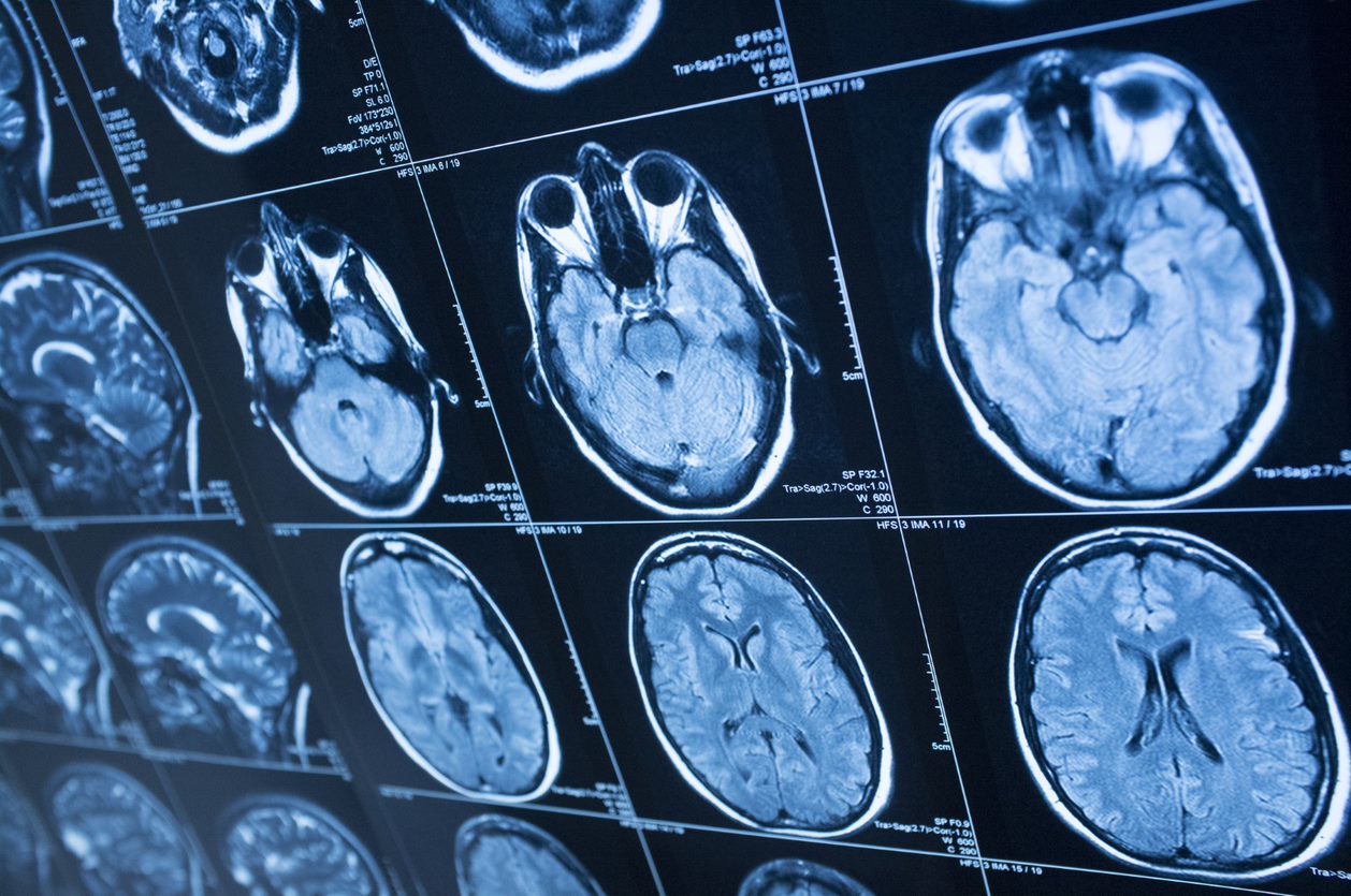 Multiple images of brain scans