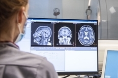 Person sat at a computer screen displaying multiple images of a brain scan