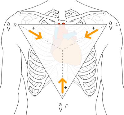 Diagram showing the line of site of the unipolar leads